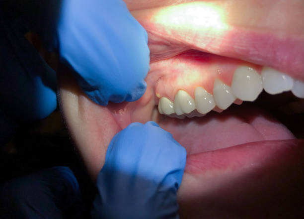 Best Emergency Gum Pain Relief  in Auburn, IL